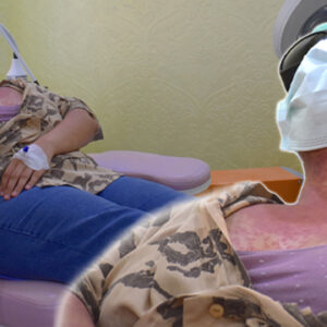 beyazlatici faciasi bu krem kezzap gibi yakiyor DDiFLEA2